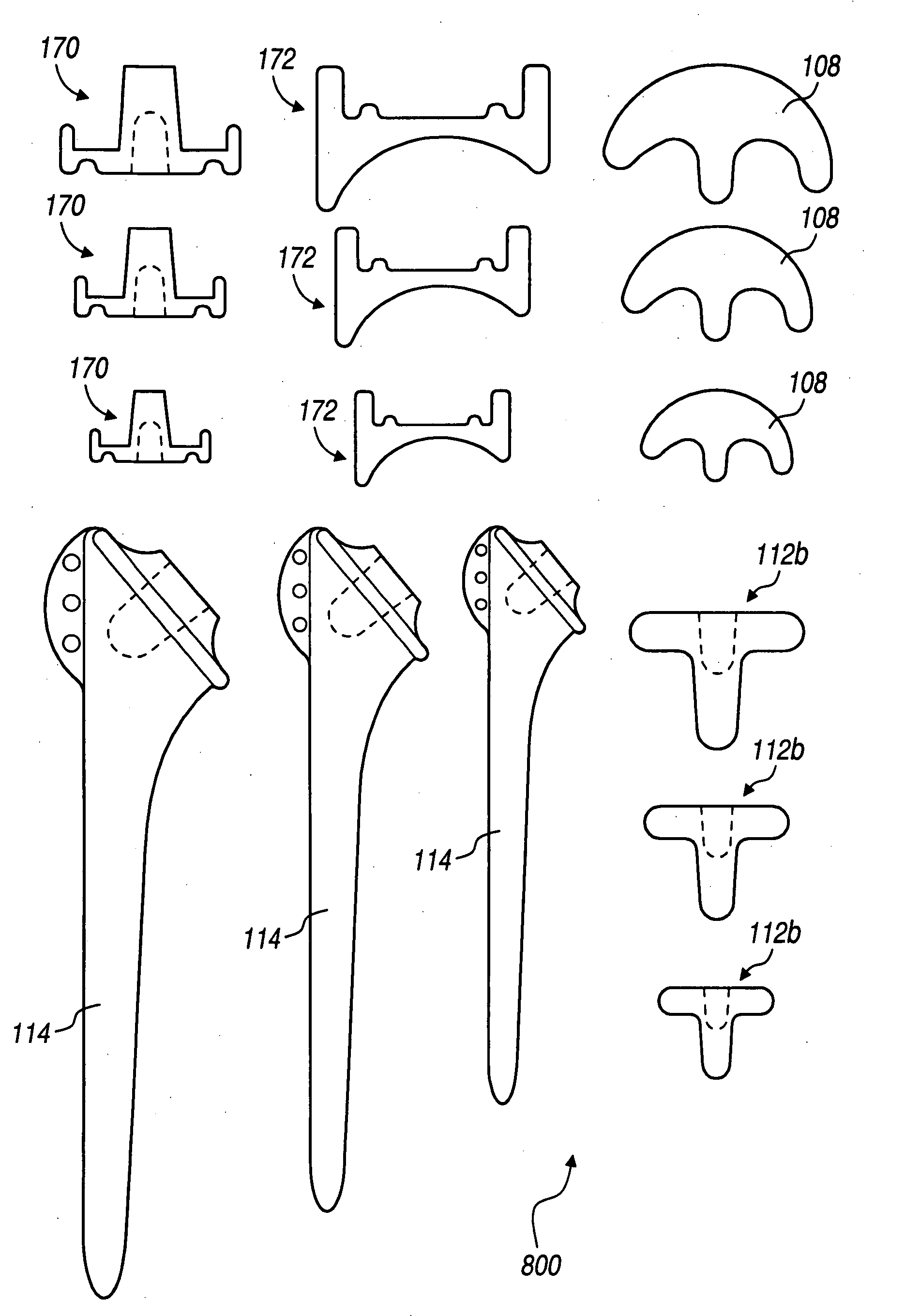 Shoulder implant assembly