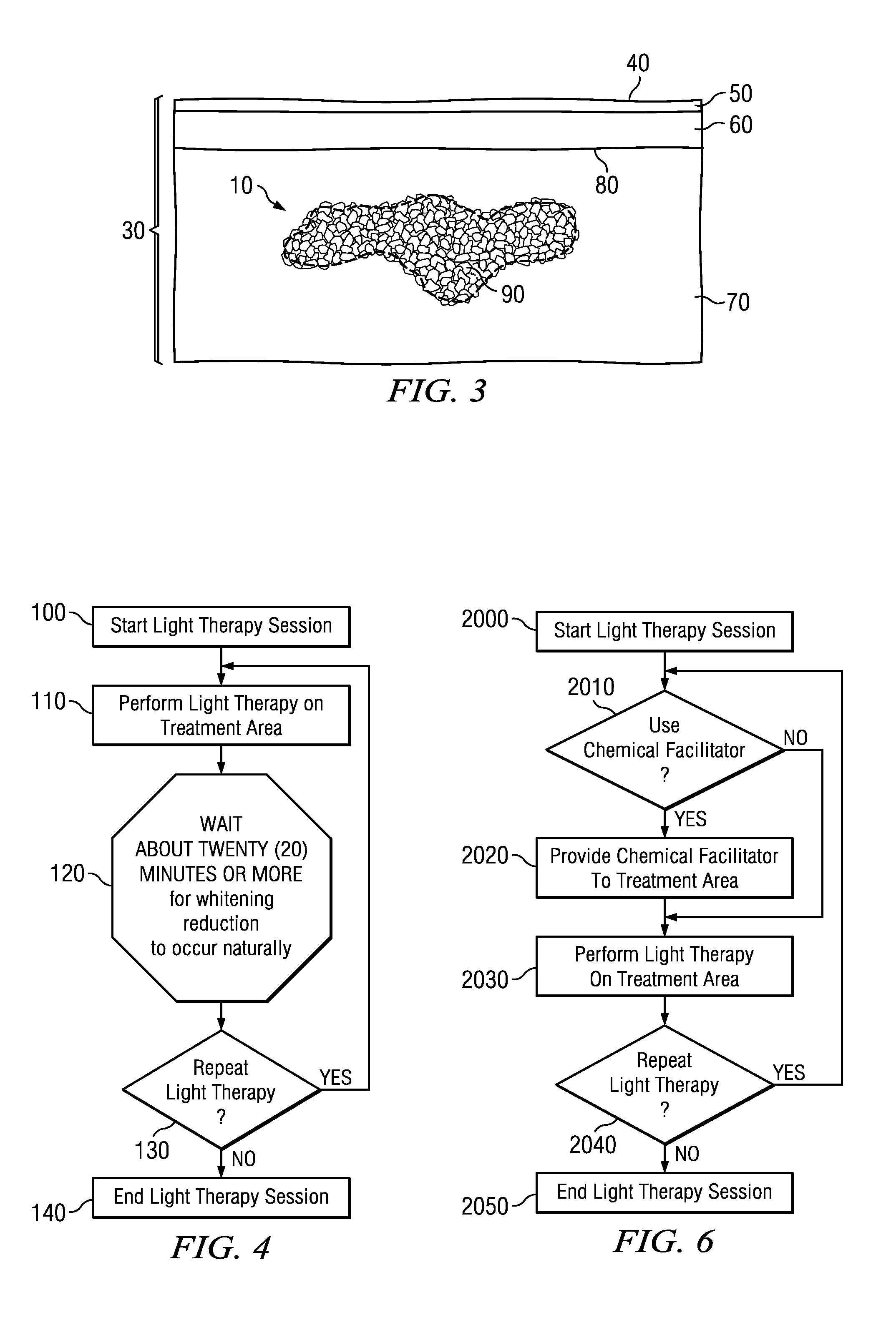 Tattoo Removal System and Method