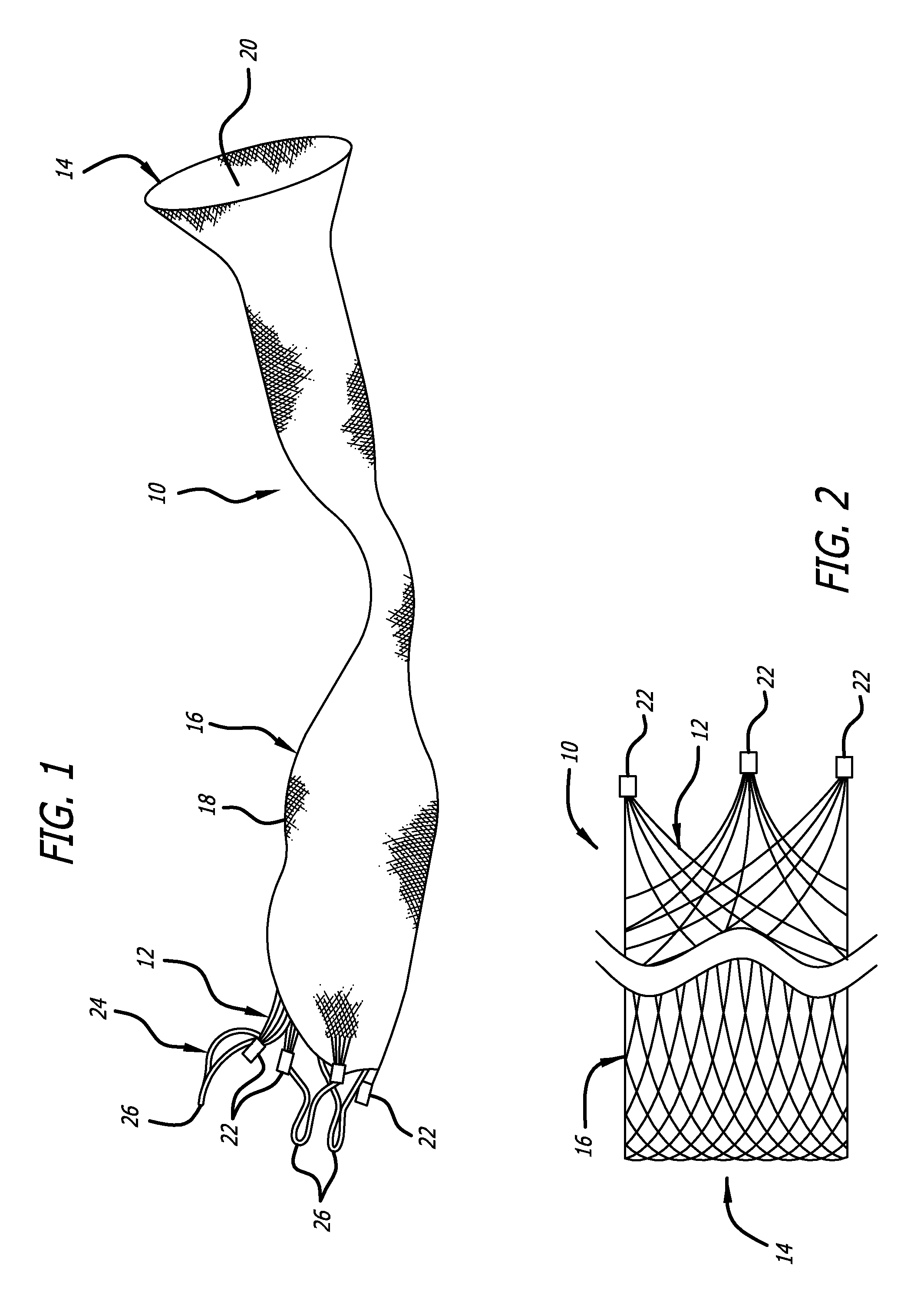 Stentless Support Structure