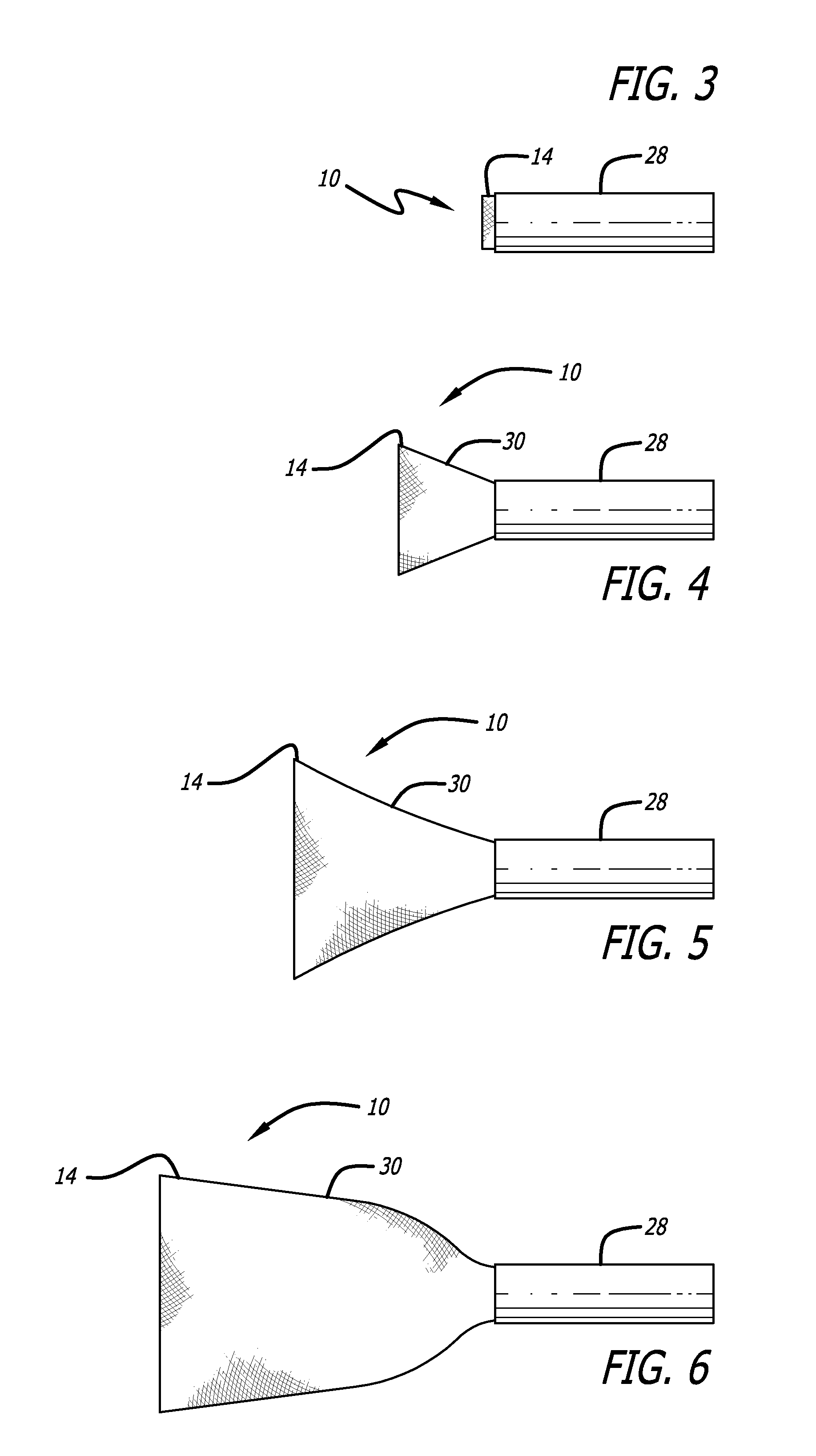 Stentless Support Structure