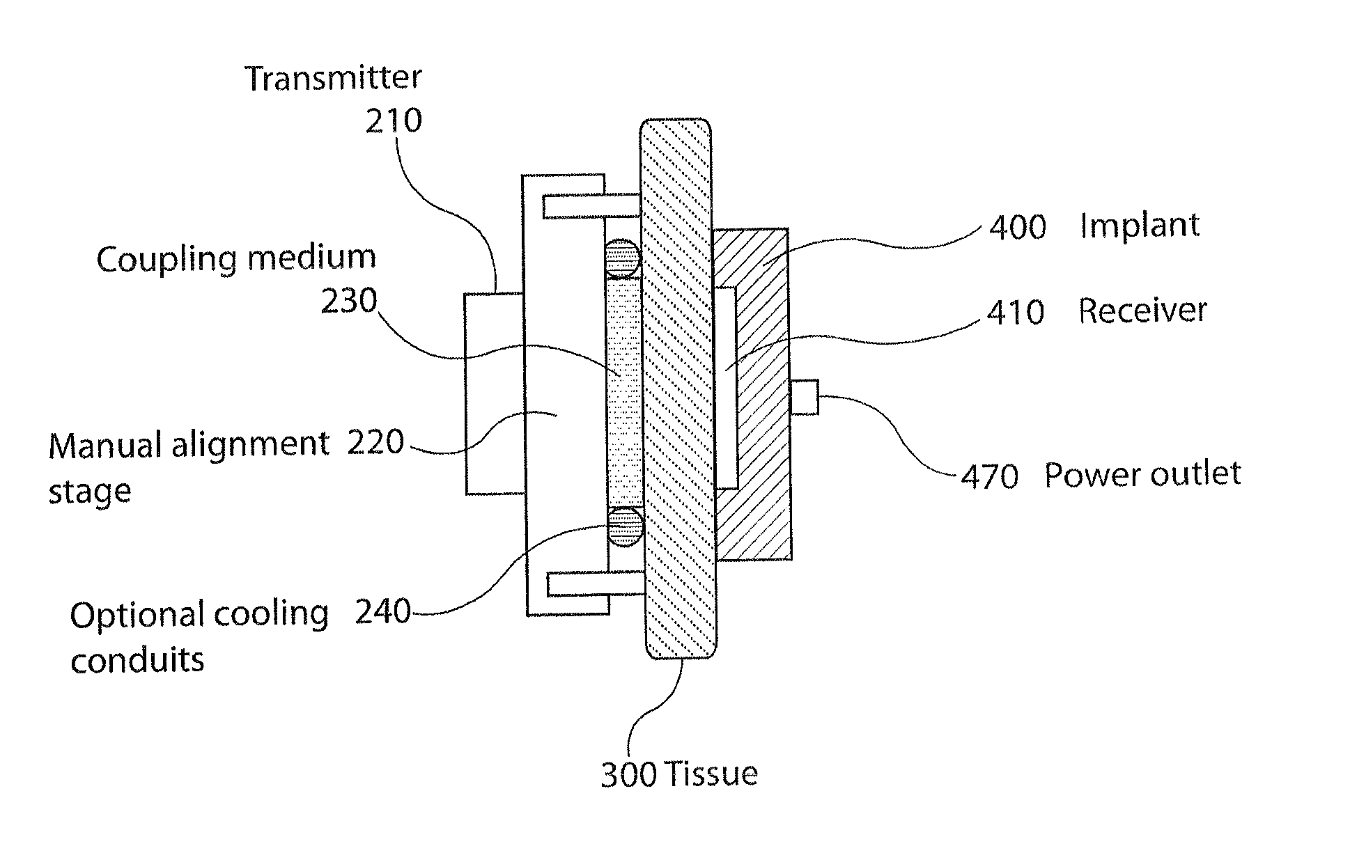 High power ultrasound wireless transcutaneous energy transfer (US-TET) source