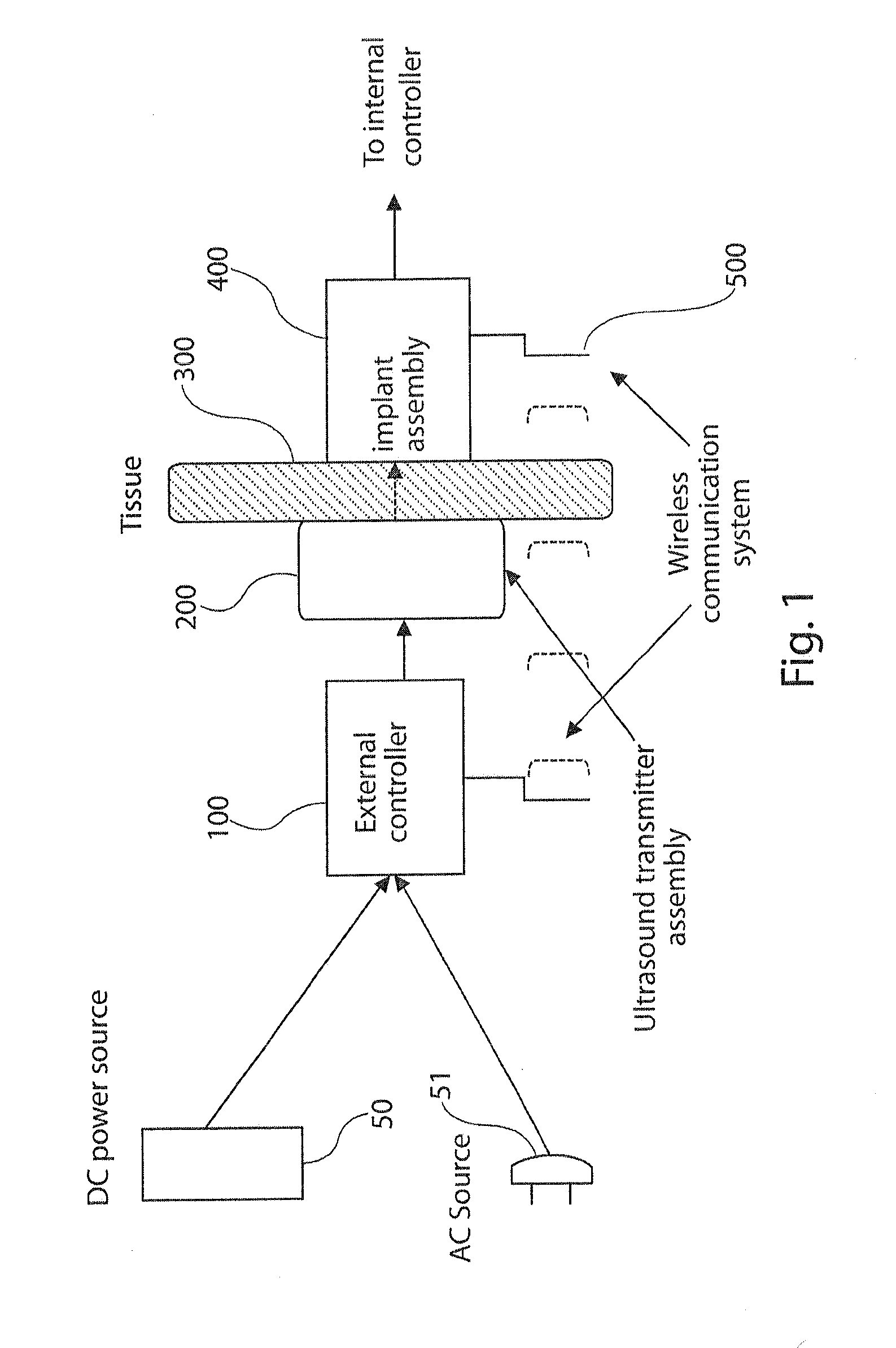 High power ultrasound wireless transcutaneous energy transfer (US-TET) source