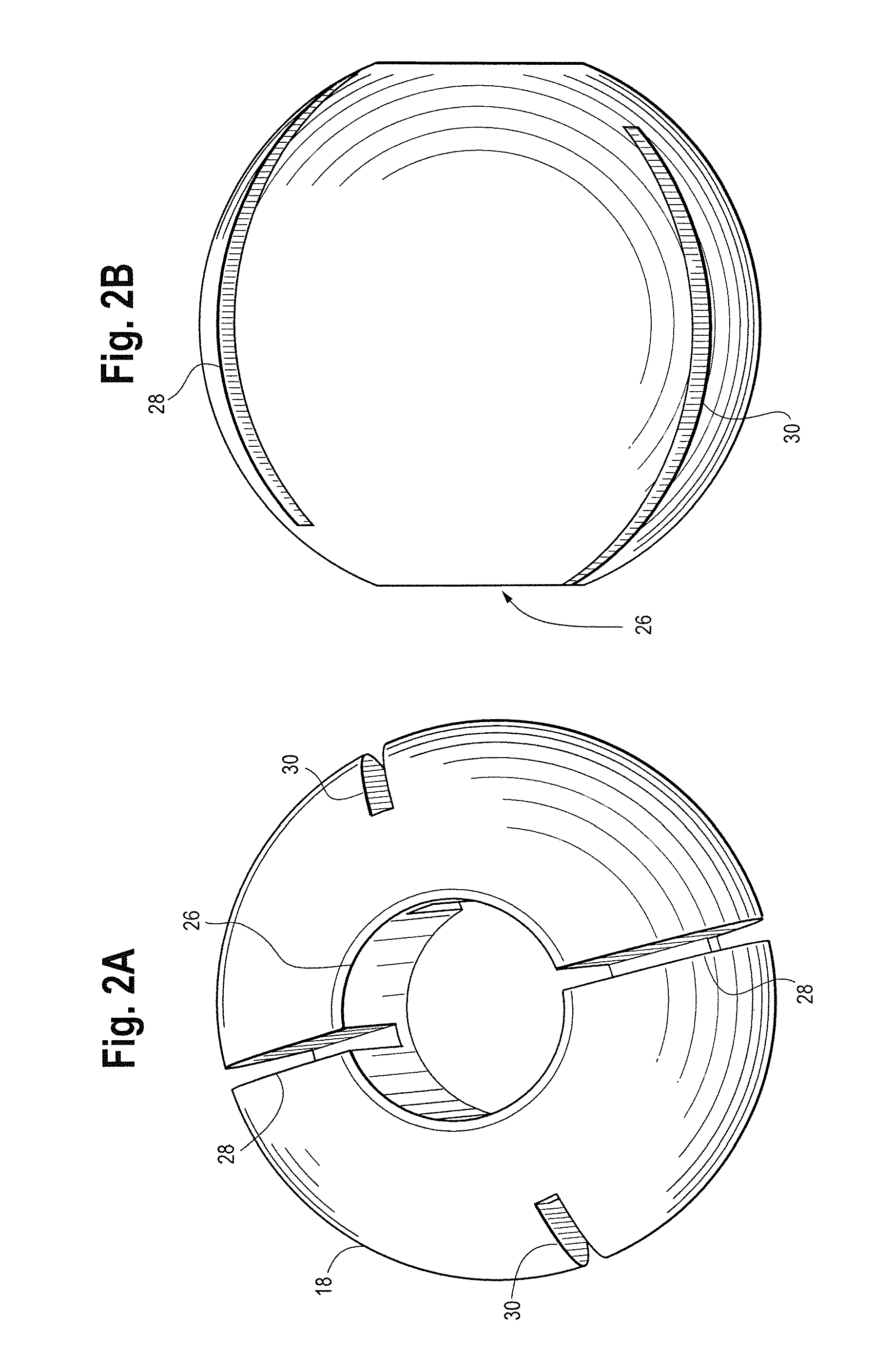 External Bone Fixation System