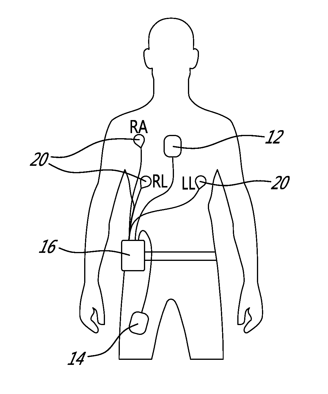 Activity, posture and heart monitoring system and method