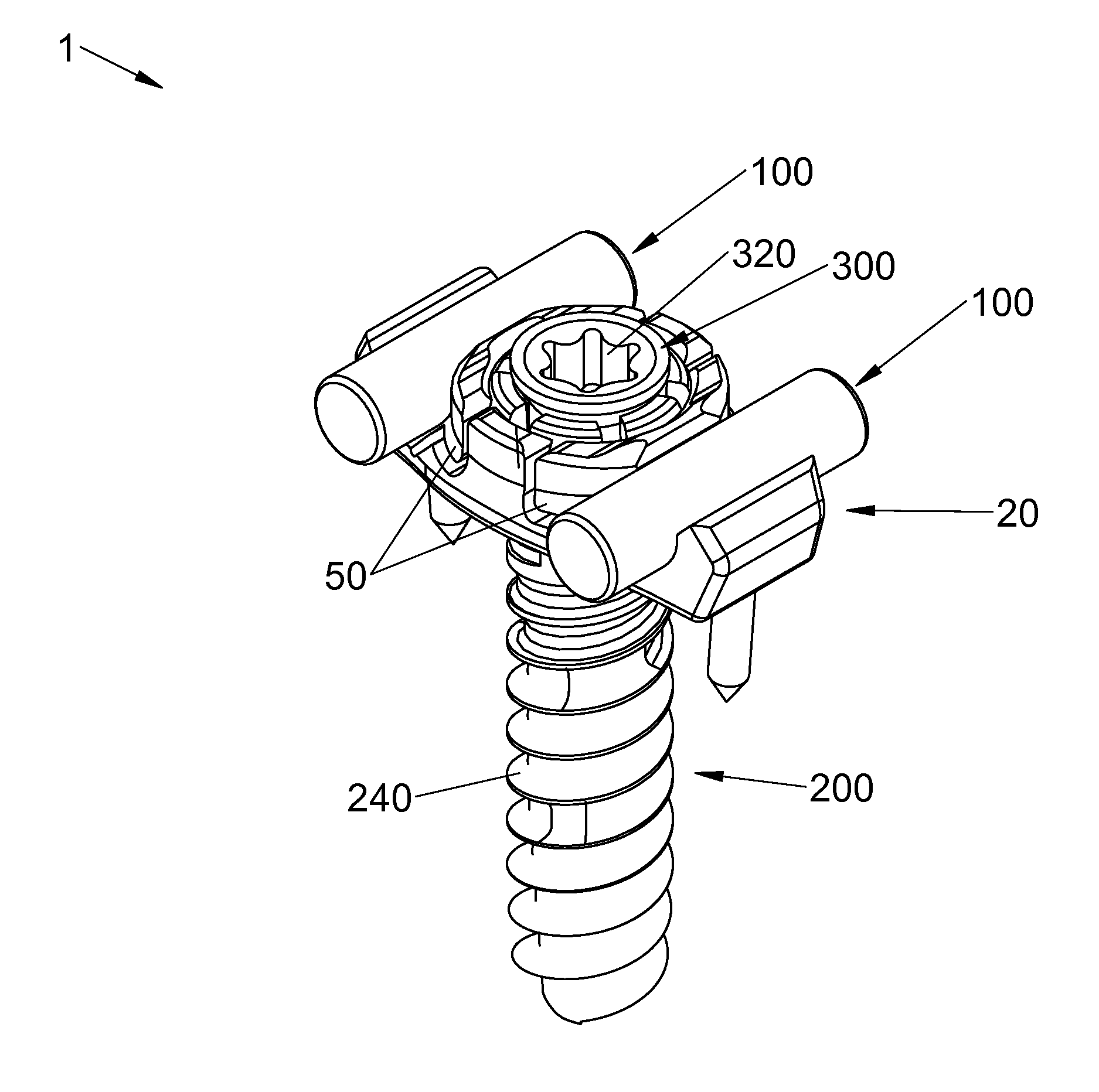 Spinal stabilization system