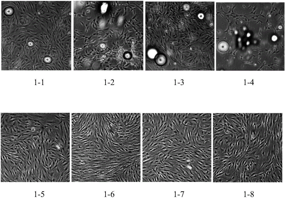 Construction method of human adipose derived stem cell bank