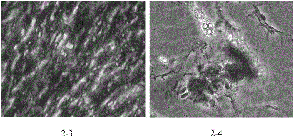 Construction method of human adipose derived stem cell bank