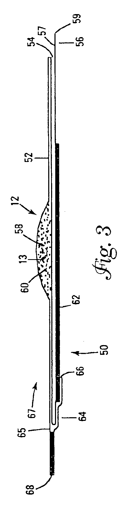 Material delivery system