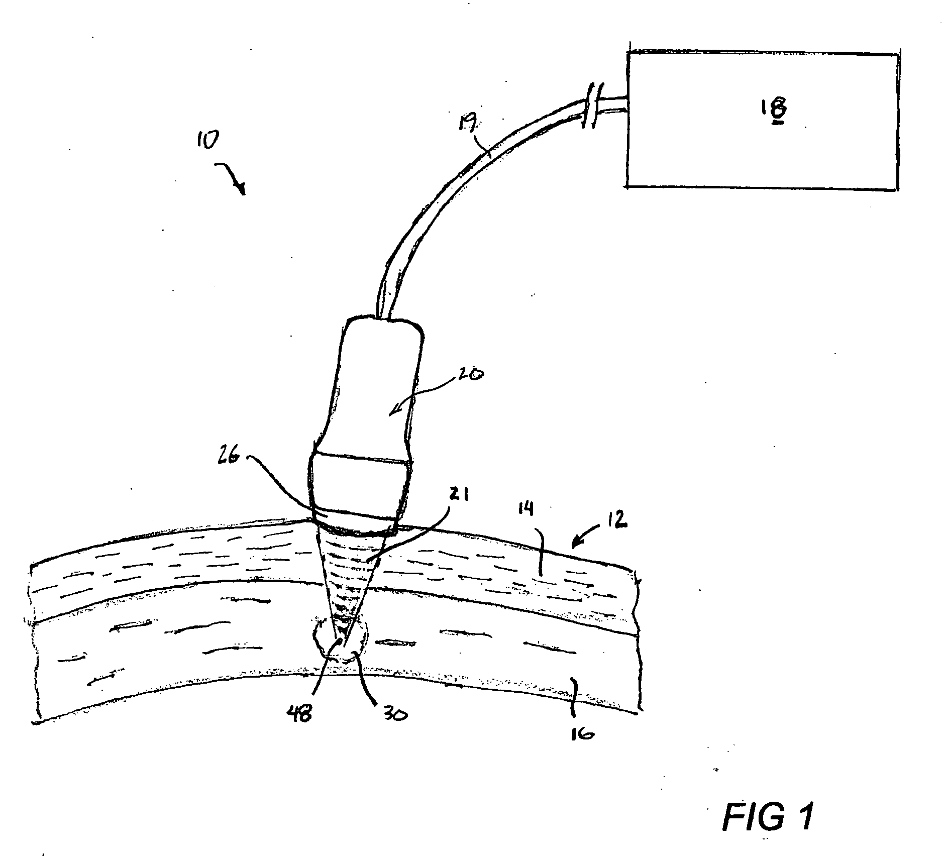 Treatment of skin with acoustic energy