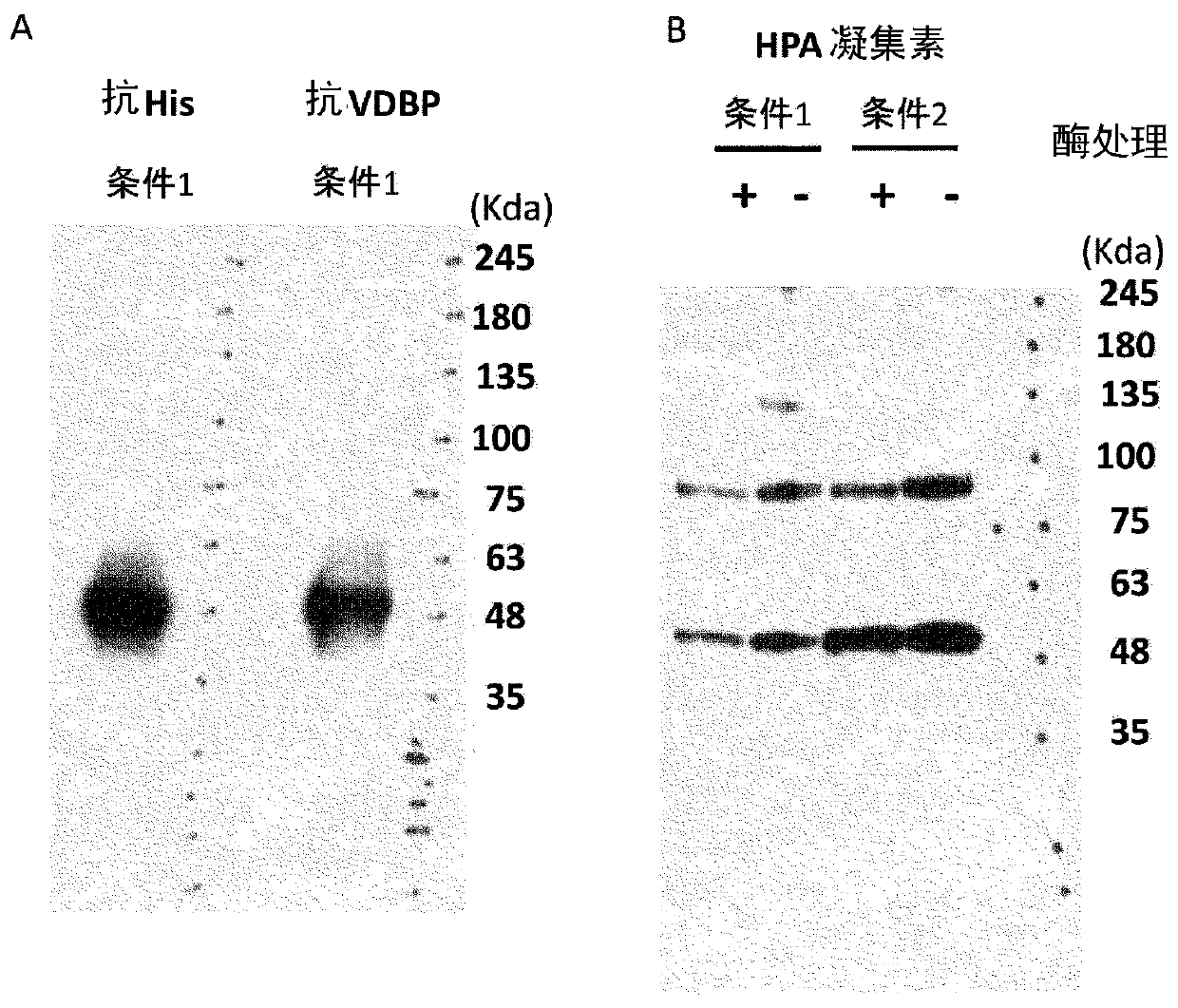 Method for producing active GcMAF