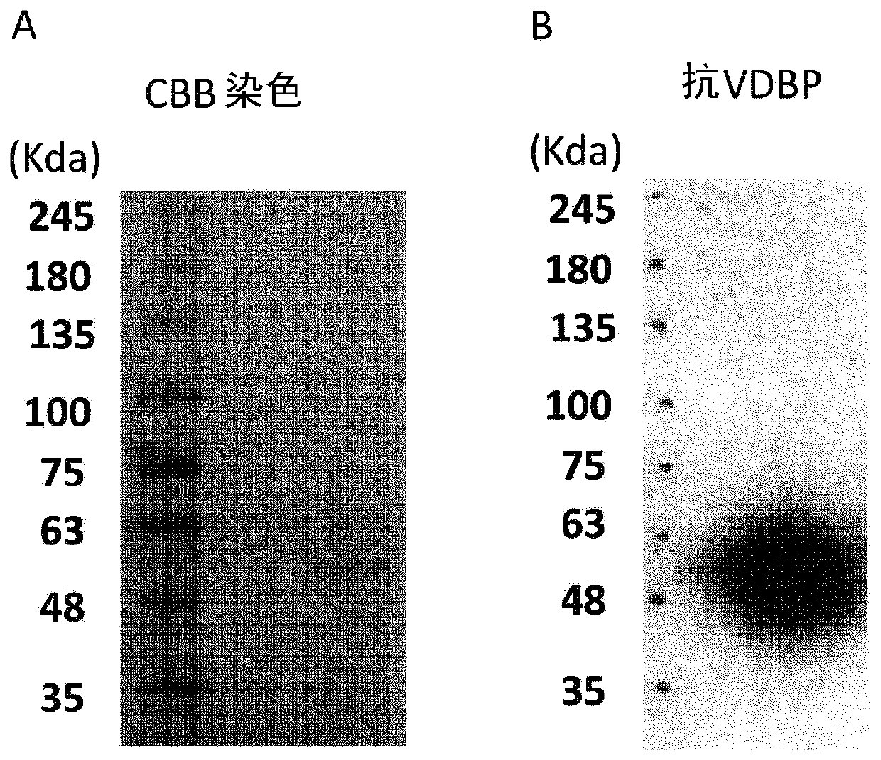 Method for producing active GcMAF