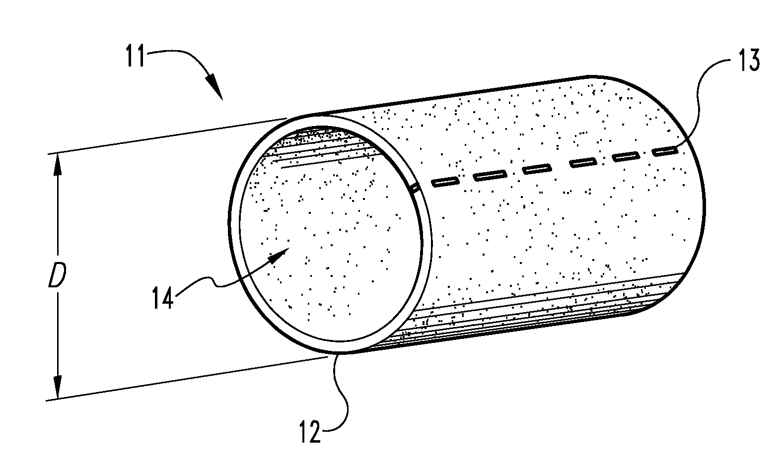 Graft prosthesis, materials and methods