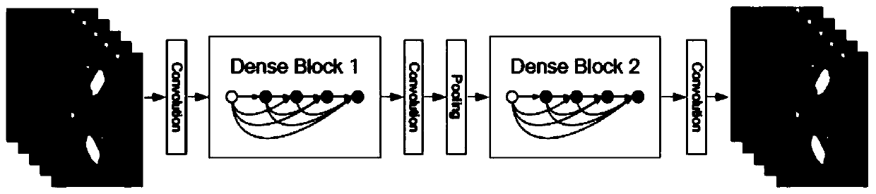 Low-dose CT imaging method, device and system based on deep dense network