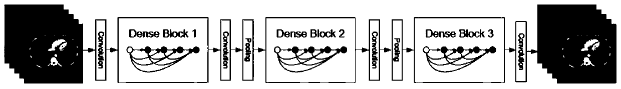 Low-dose CT imaging method, device and system based on deep dense network