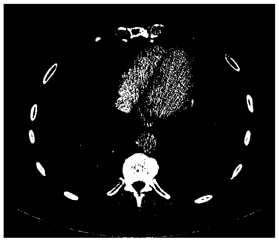 Low-dose CT imaging method, device and system based on deep dense network