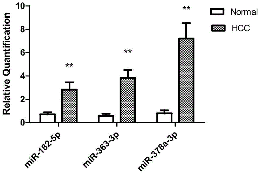 Liver cancer biomarkers and application thereof