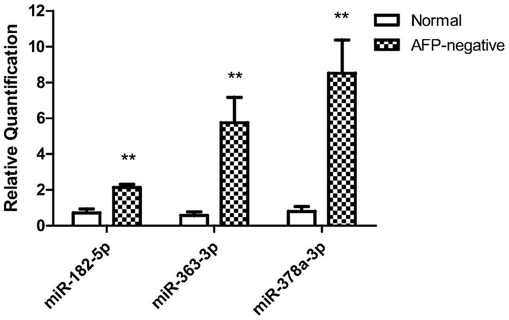 Liver cancer biomarkers and application thereof