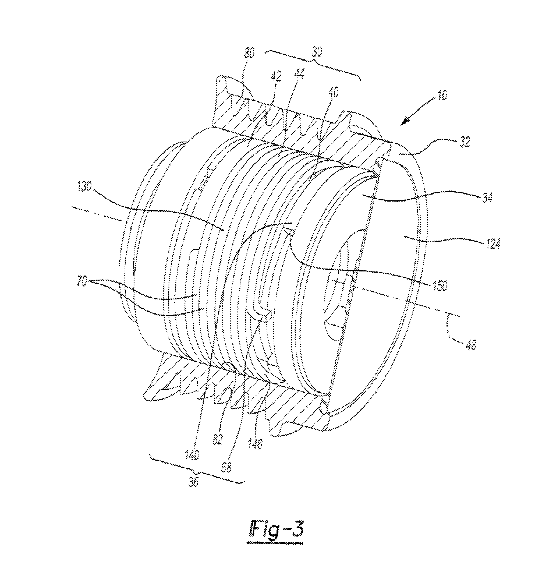 Over-running decoupler with torque limiter