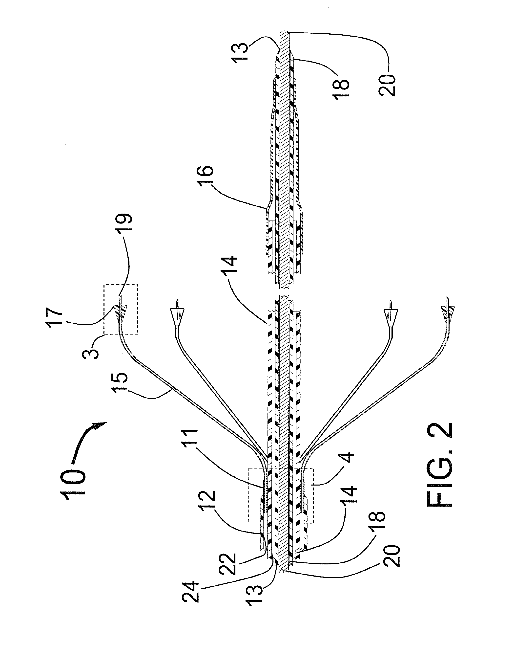 Expandable catheter system for peri-ostial injection and muscle and nerve fiber ablation