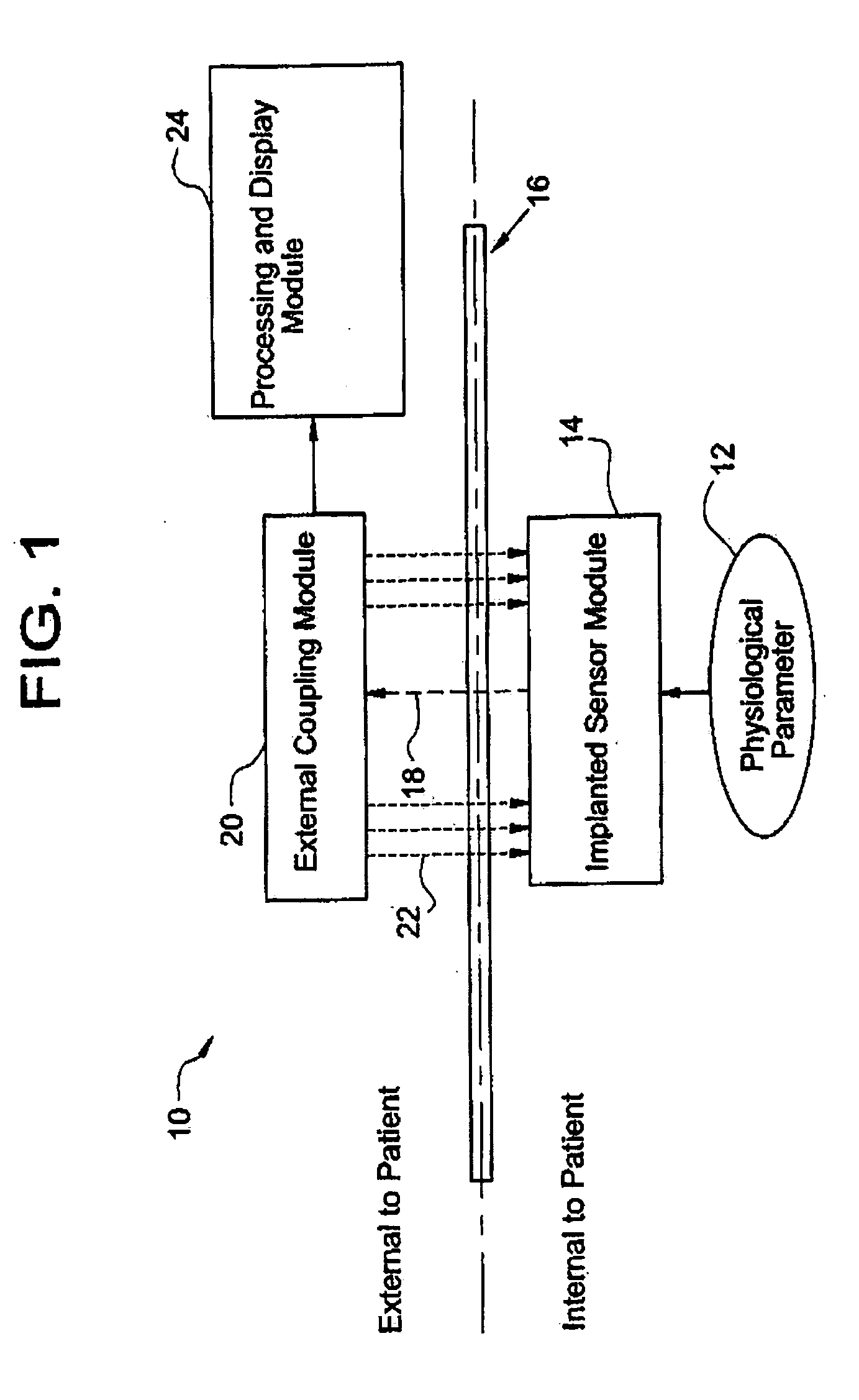 System for transcutaneous monitoring of intracranial pressure