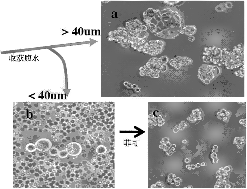 Catenae: serosal cancer stem cells