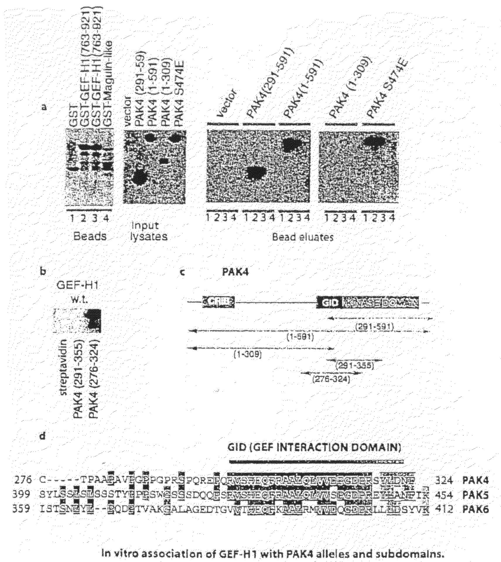 GEF-H1b: biomarkers, complexes, assays and therapeutic uses thereof