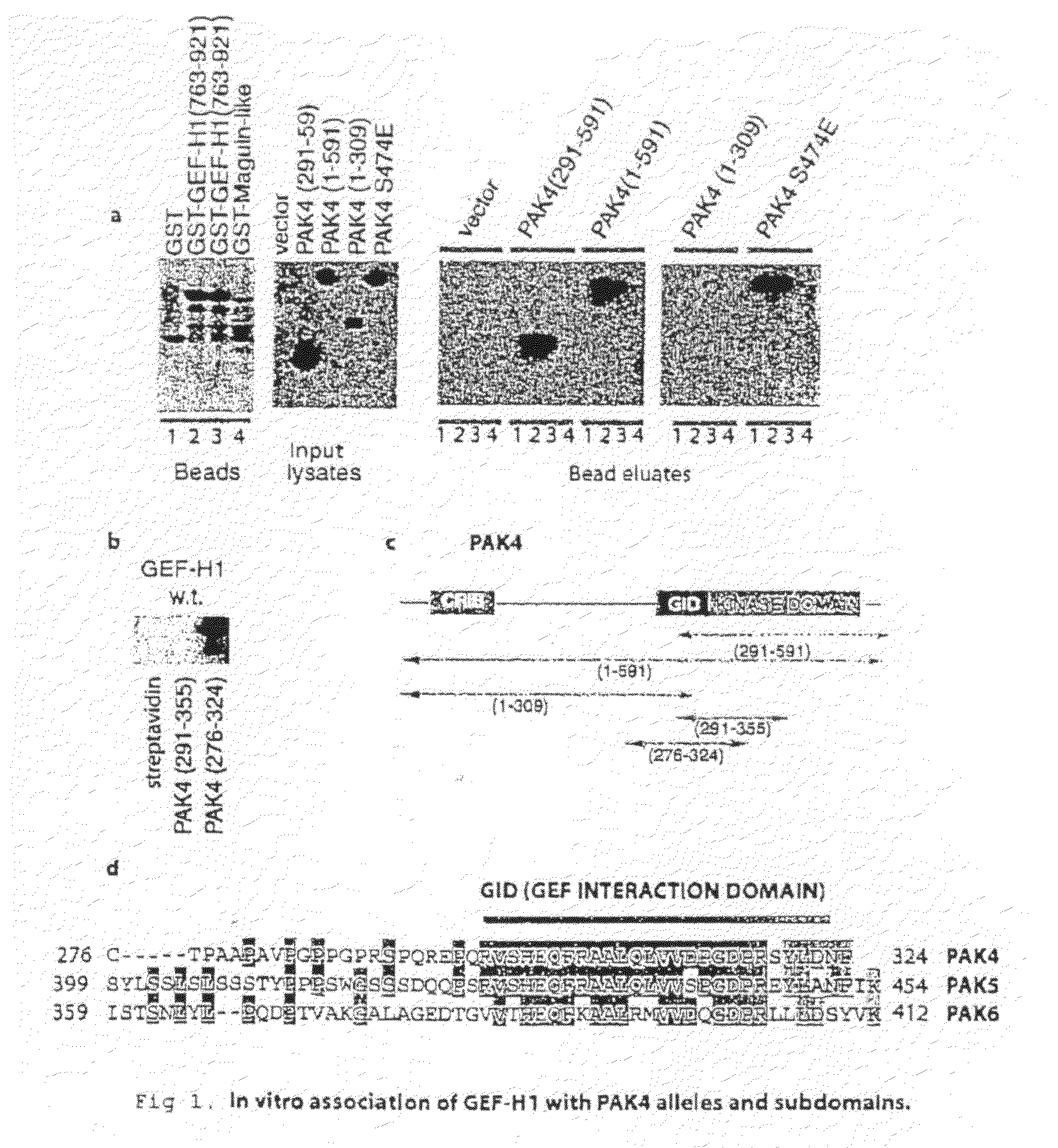 GEF-H1b: biomarkers, complexes, assays and therapeutic uses thereof