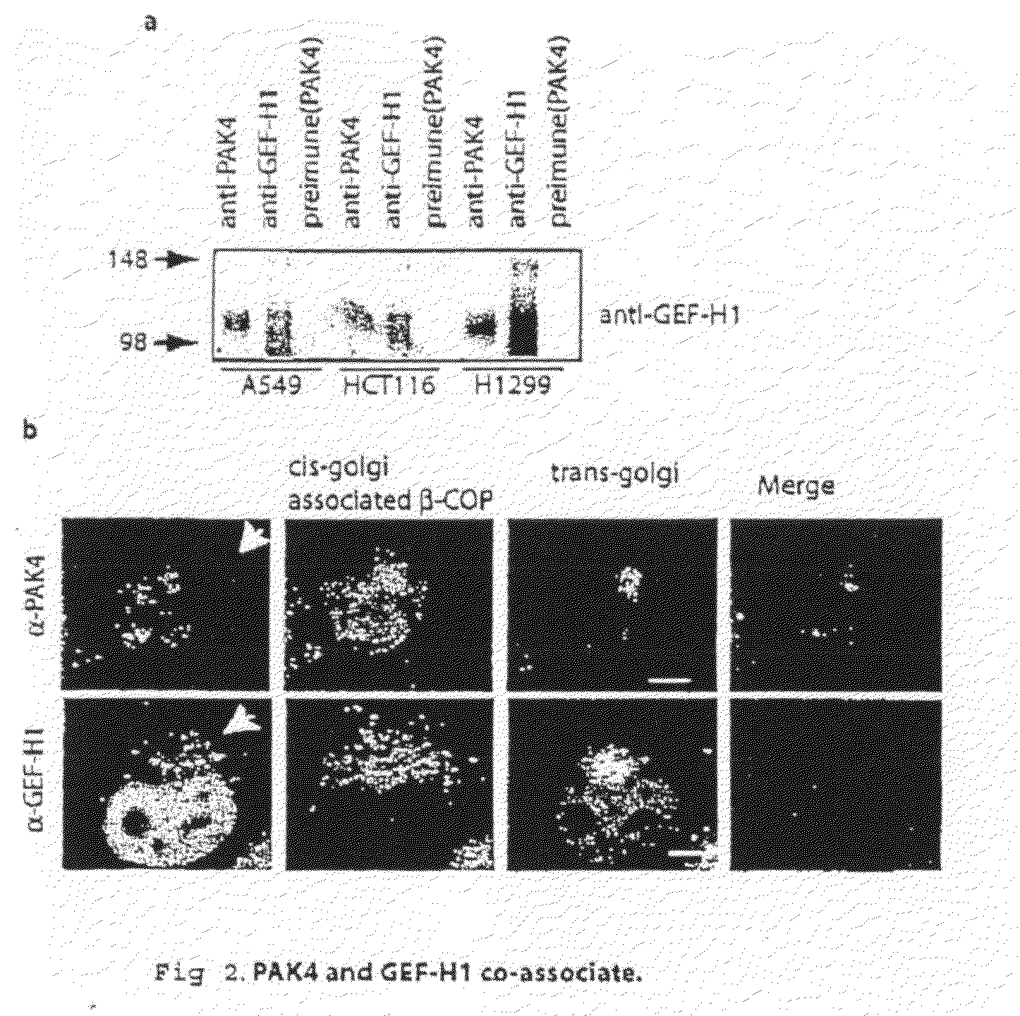 GEF-H1b: biomarkers, complexes, assays and therapeutic uses thereof