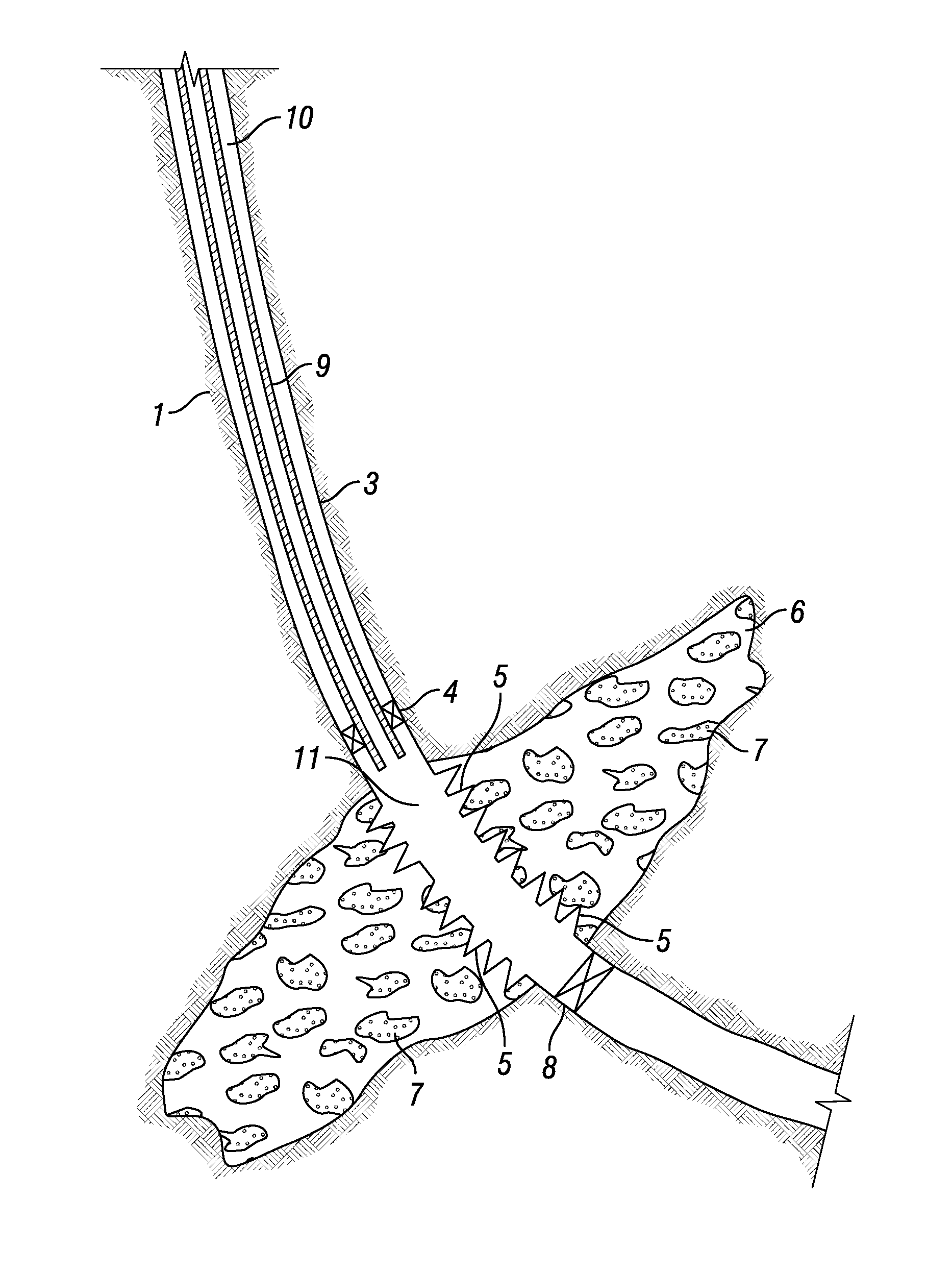 Methods of Enhancing Fracture Conductivity of Subterranean Formations Propped with Cement Packs