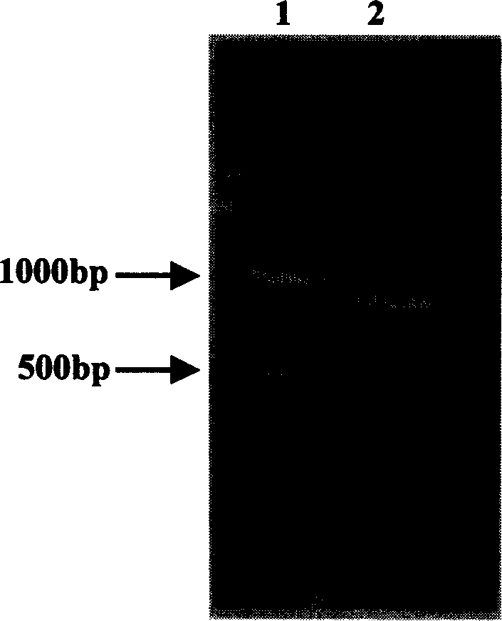 Recombinant expression vector expressing human pancreatic tissue kallikrein gene and prepn of human pancreatic tissue kallikrein