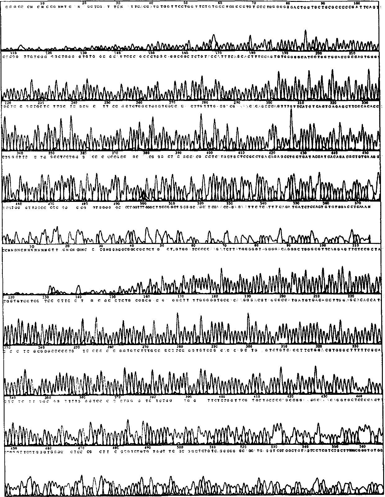 Recombinant expression vector expressing human pancreatic tissue kallikrein gene and prepn of human pancreatic tissue kallikrein