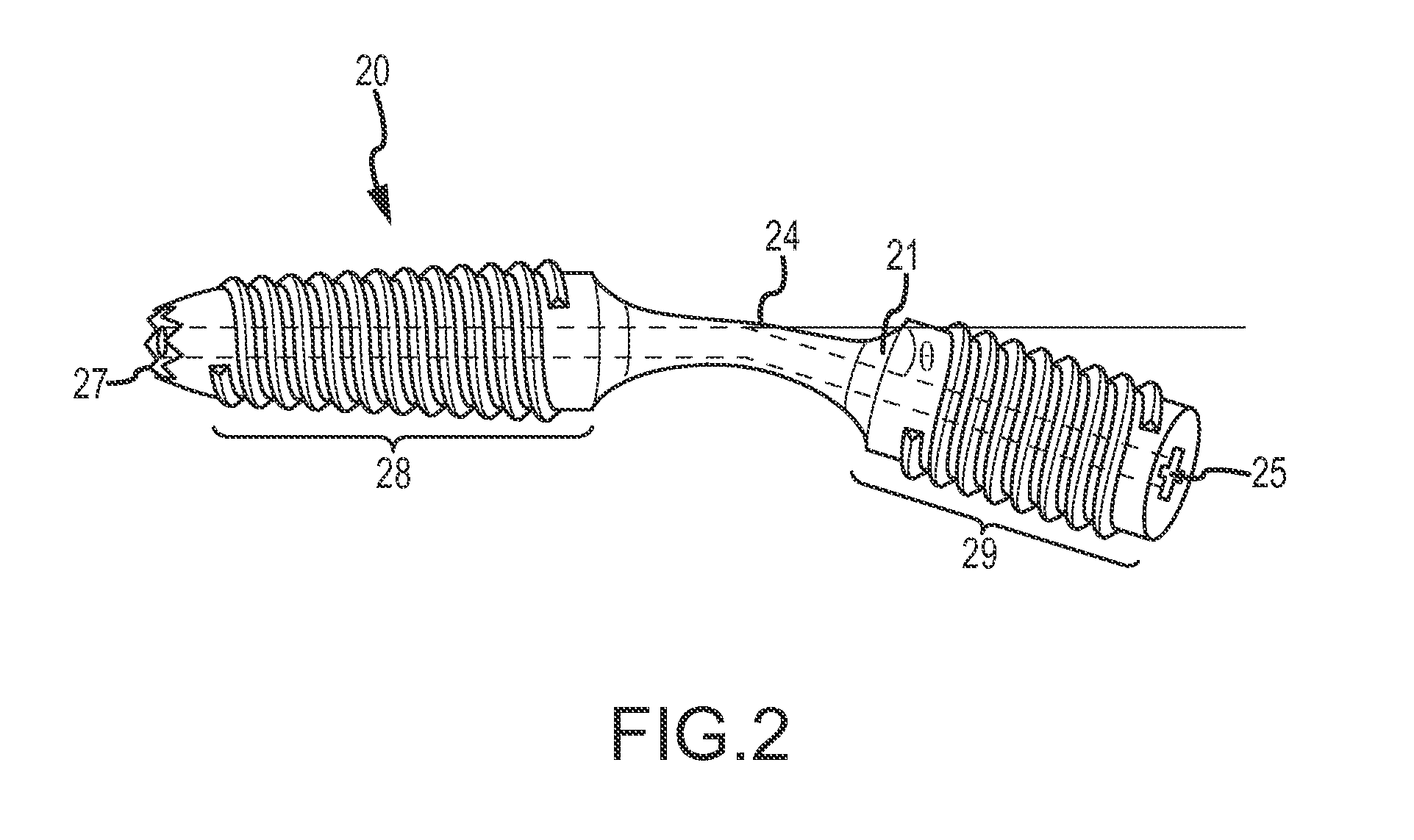 Bent dip fusion screw