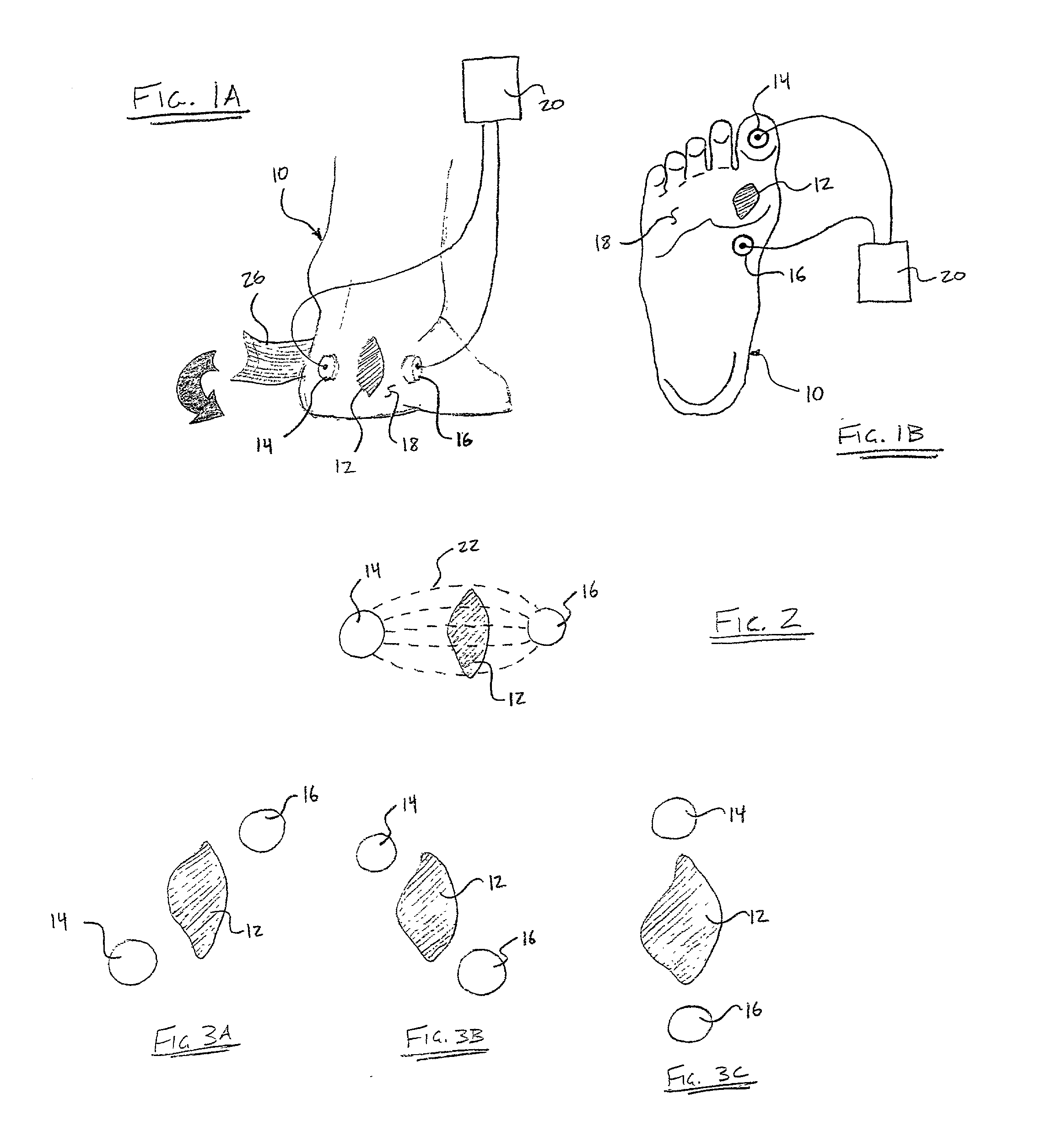 Non-invasive capacitively coupled electrical stimulation device for treatment of soft tissue wounds