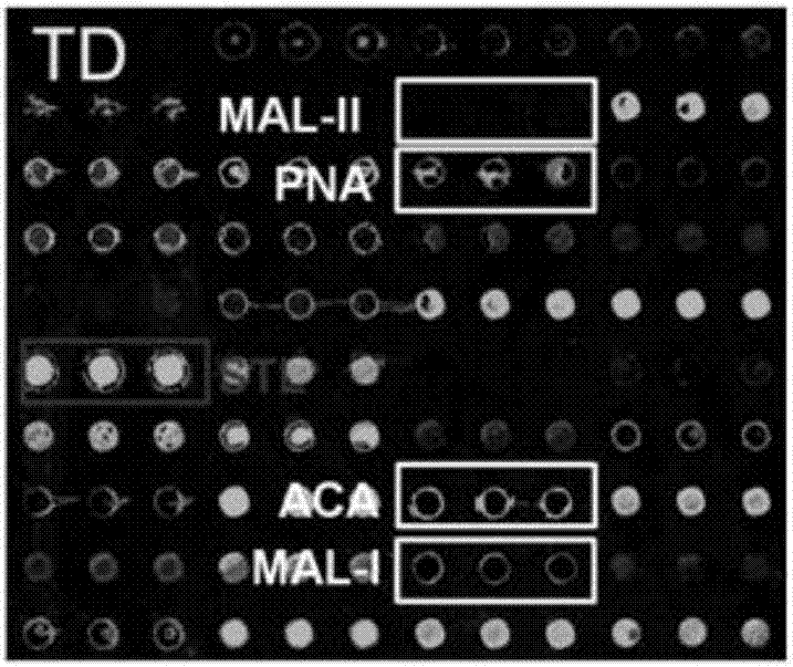 Application of a serum glycoprotein marker for autism