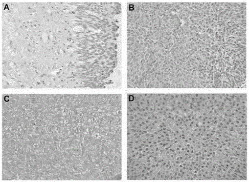 Method and reagent kit for detecting expression quantities of TROP2 (trophoblastic cell surface antigen 2) proteins