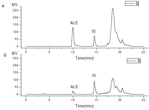 Alendronate sodium solid lipid nanoparticle and preparation method thereof