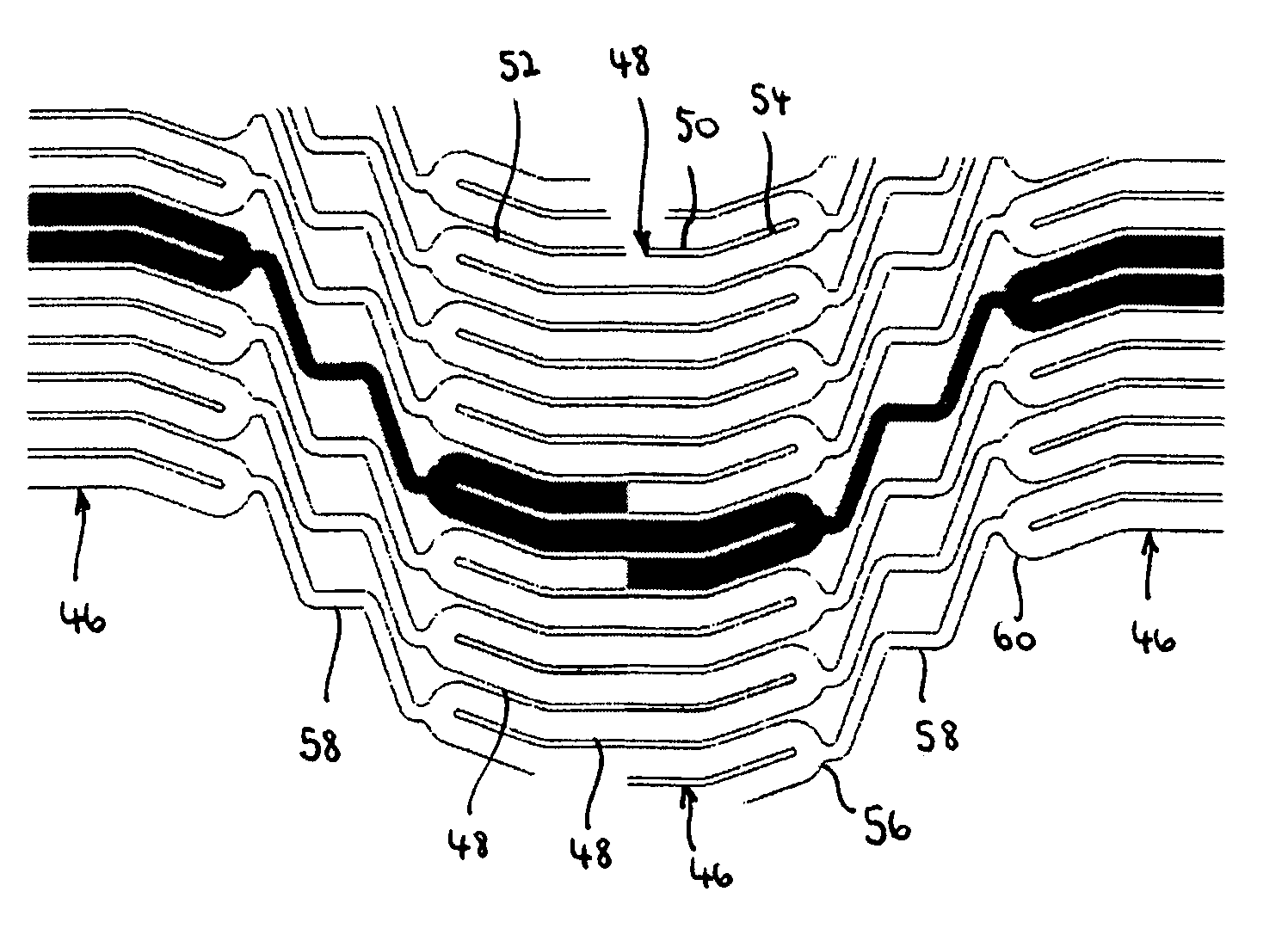 Flexible stent with torque-absorbing connectors