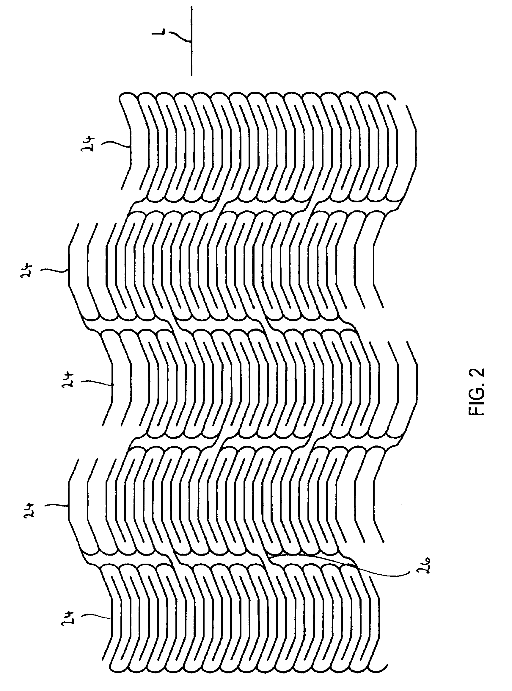 Flexible stent with torque-absorbing connectors