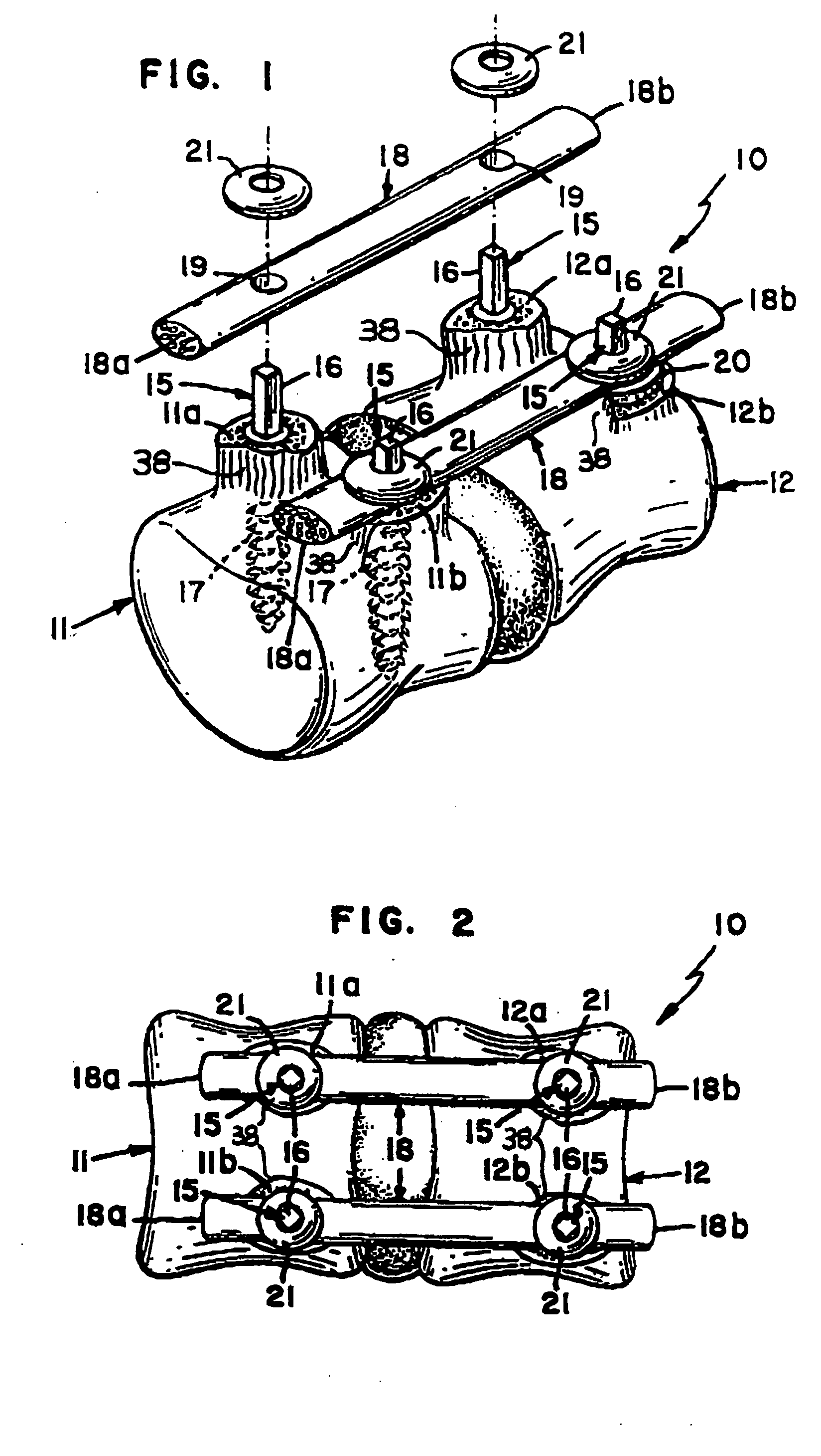 Integral flexible spine stabilization device and method