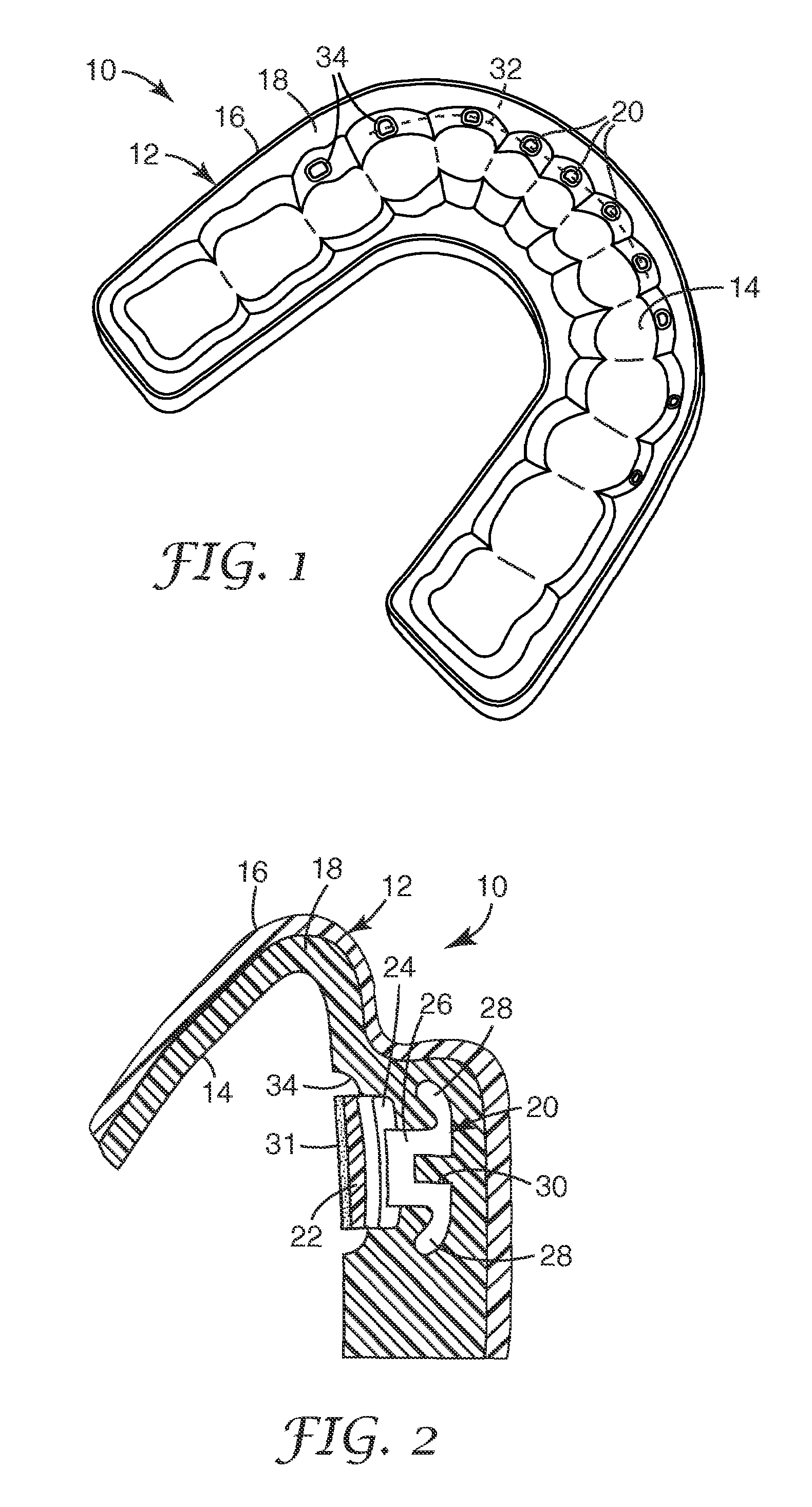 Orthodontic indirect bonding tray with moisture control