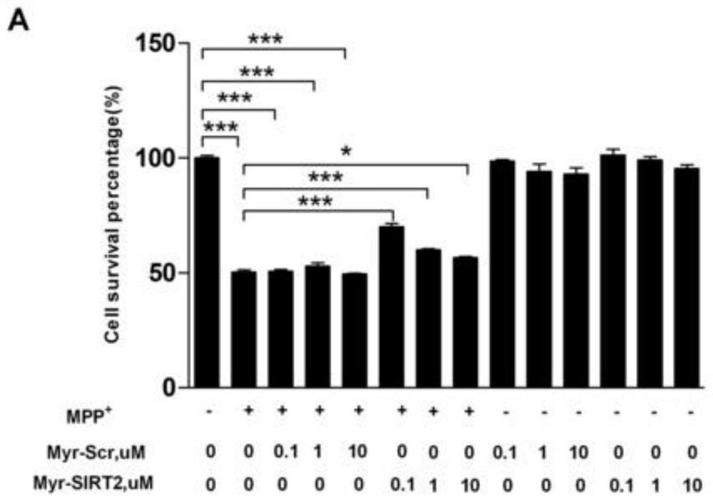 Small molecule polypeptide and application thereof in preparation of medicine for preventing and treating Parkinson's disease