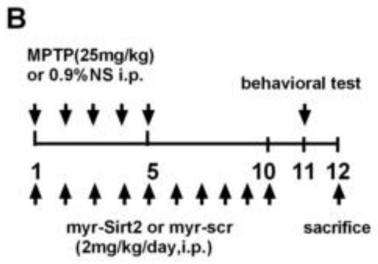 Small molecule polypeptide and application thereof in preparation of medicine for preventing and treating Parkinson's disease