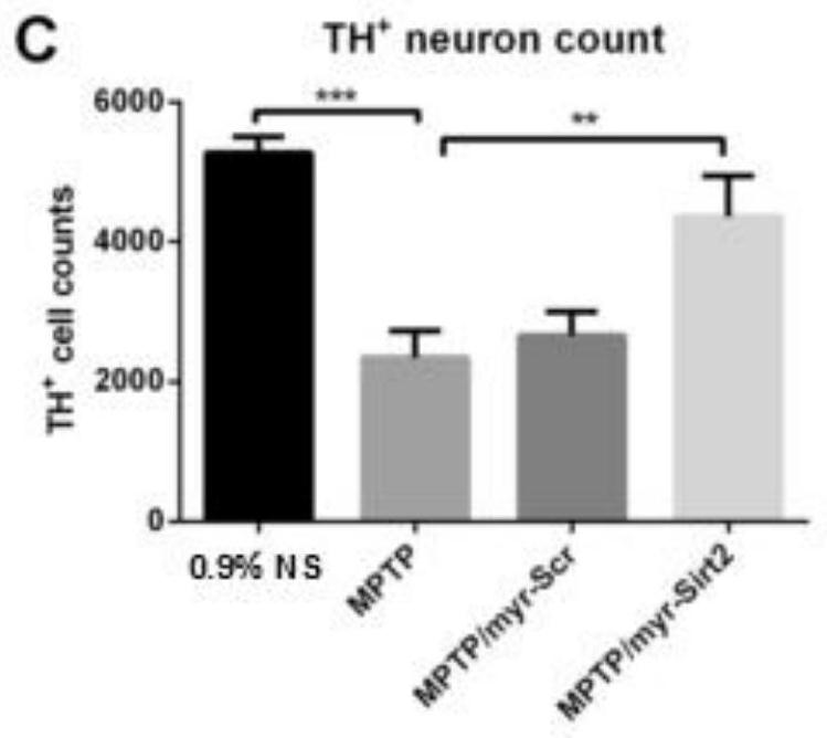 Small molecule polypeptide and application thereof in preparation of medicine for preventing and treating Parkinson's disease