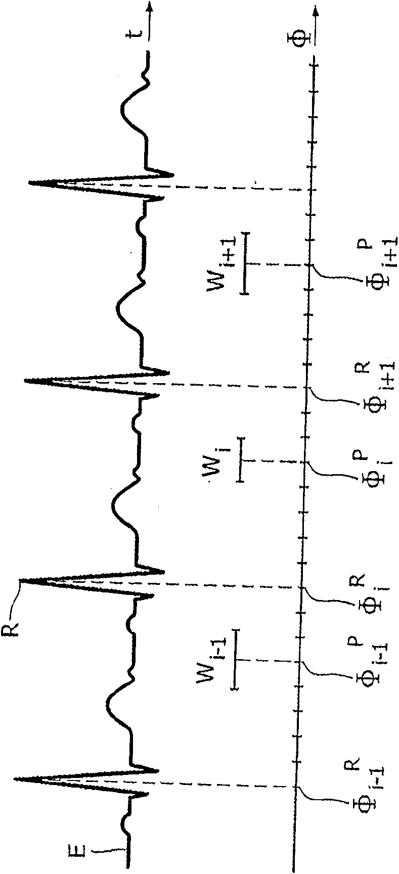 Ct method for the examination of a cyclically moving object