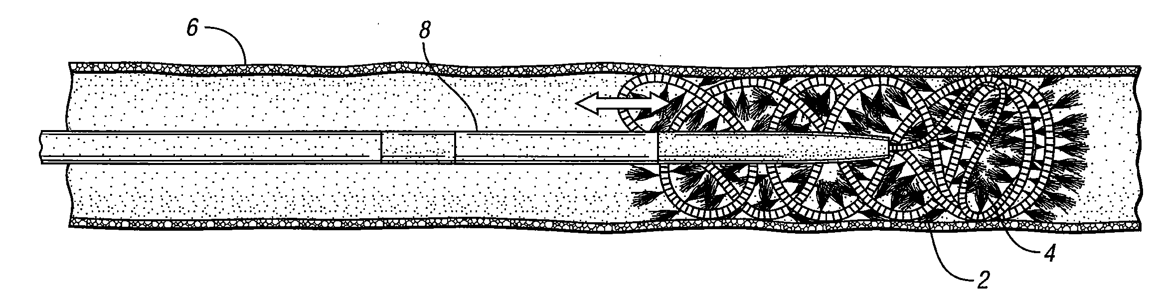 Loading device for delivering an embolization coil into a microcatheter