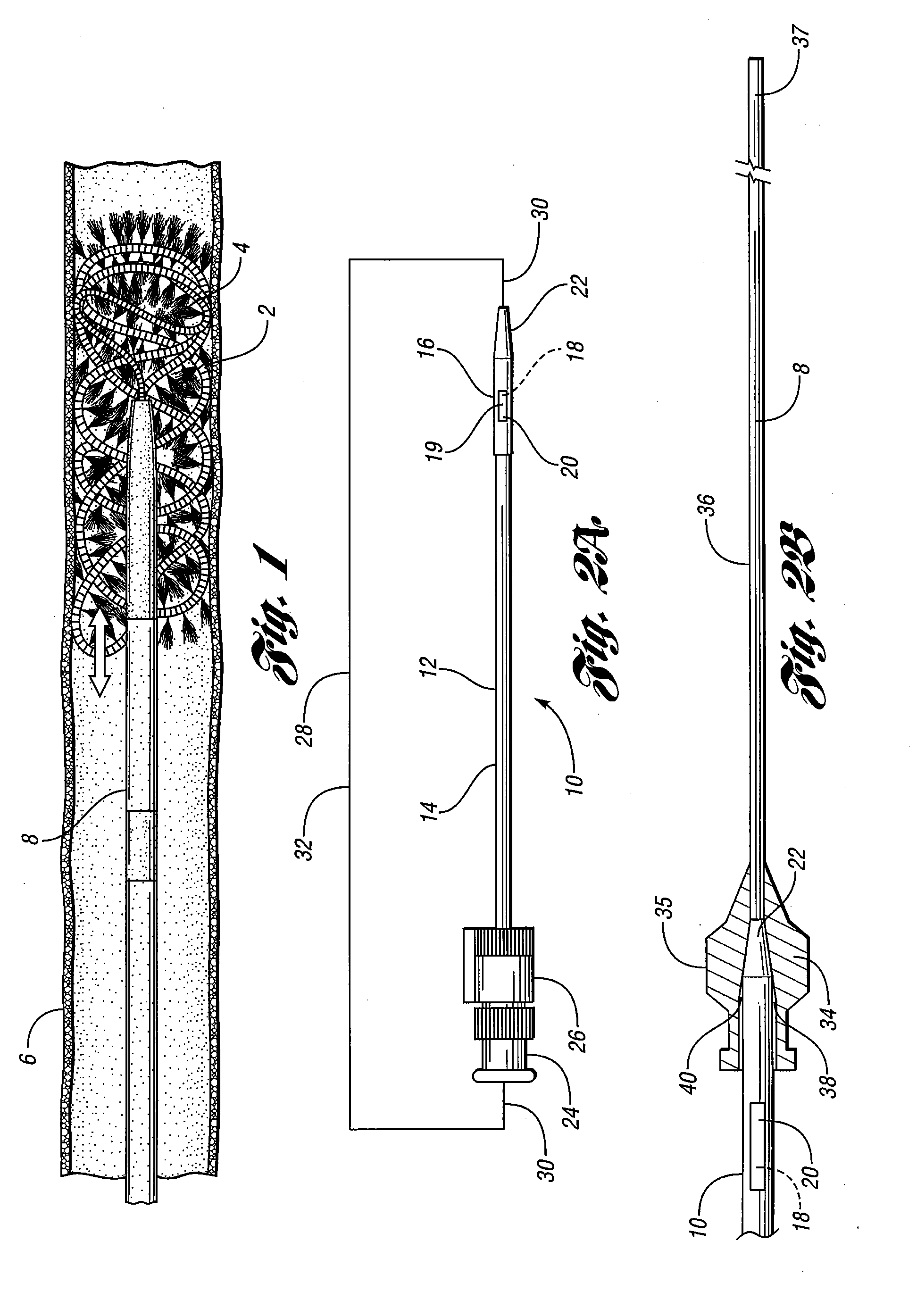 Loading device for delivering an embolization coil into a microcatheter