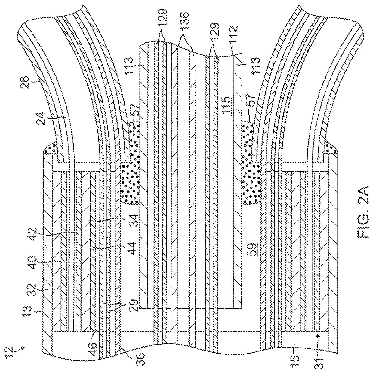 Catheter with multiple spines of different lengths arranged in one or more distal assemblies