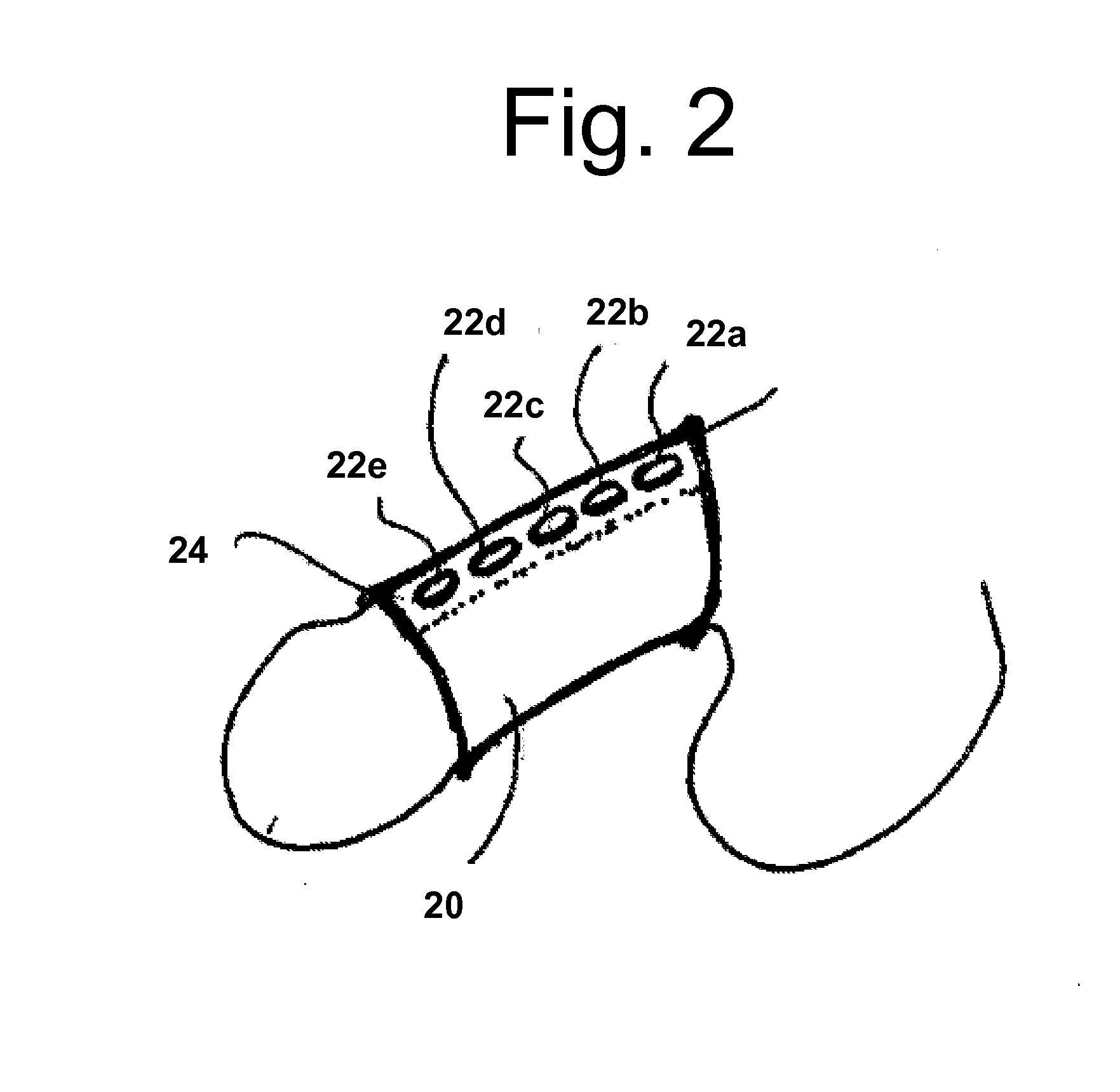 Systems and methods for the treatment of pelvic disorders including magnetic particulates