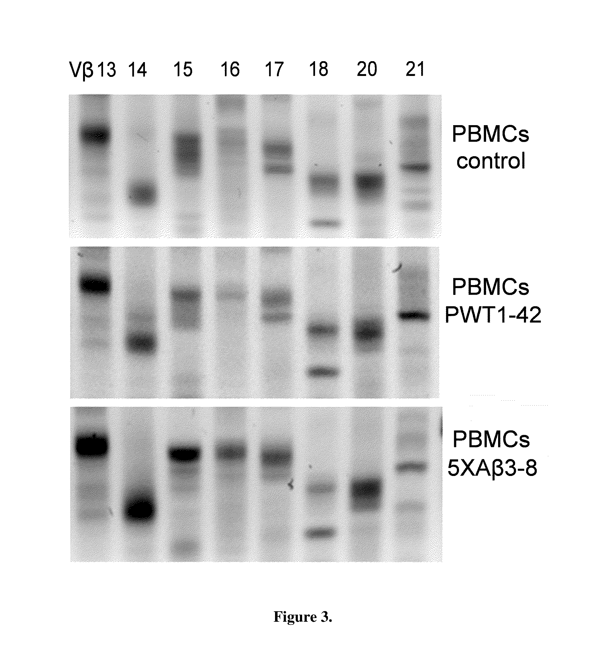 Method of diagnosing or assessing risk for Parkinson's disease or Alzheimer's disease using TCR clonality