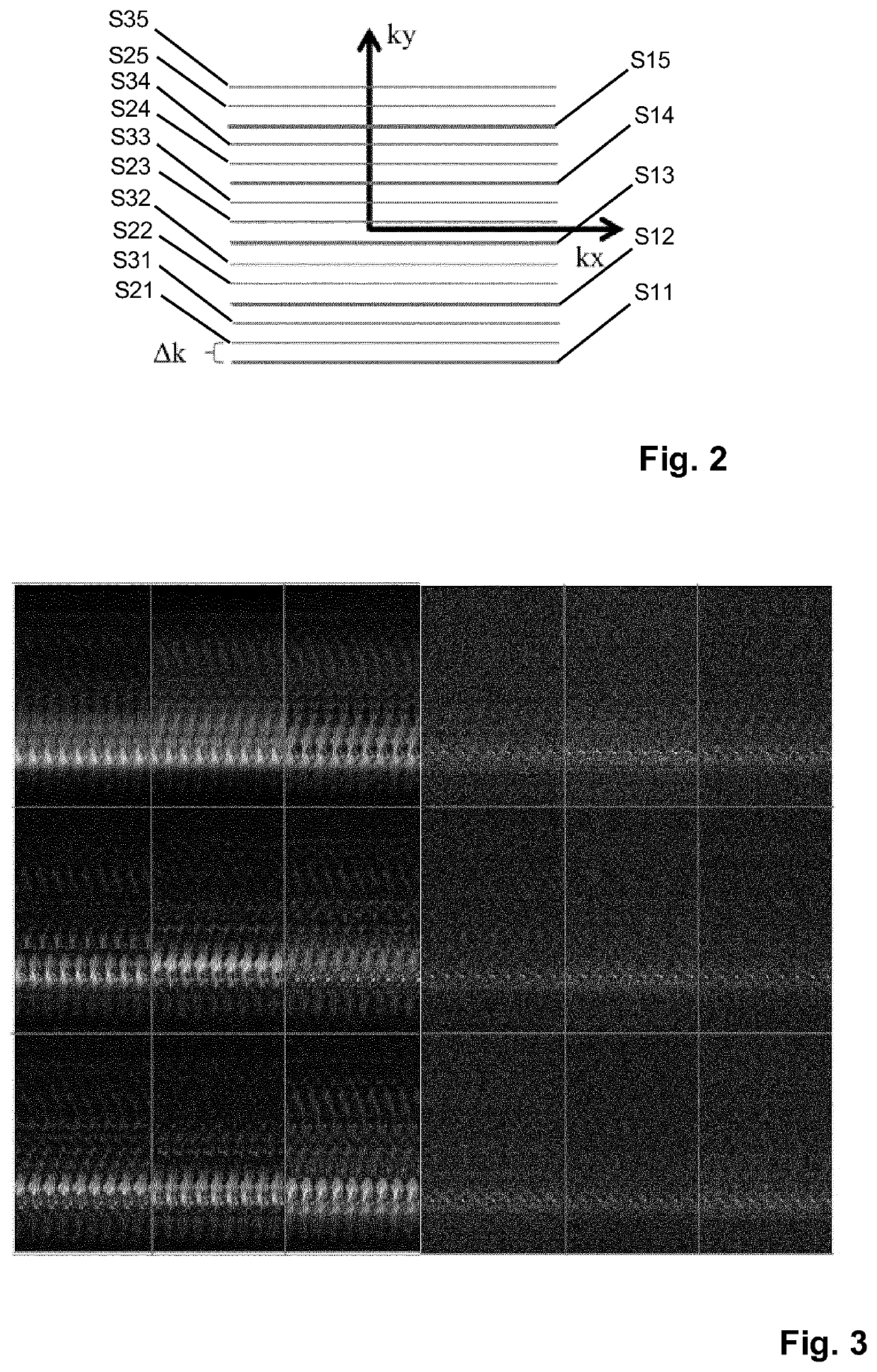 MR imaging with motion detection